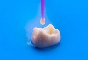a tooth undergoing dental bonding